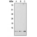 LifeSab™ RBBP6 Rabbit pAb (50 µl)