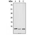 LifeSab™ SNRPD3 Rabbit pAb (50 µl)