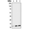 LifeSab™ TAC1 Rabbit pAb (50 µl)