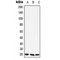 LifeSab™ YAF2 Rabbit pAb (50 µl)