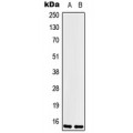 LifeSab™ LSM1 Rabbit pAb (50 µl)