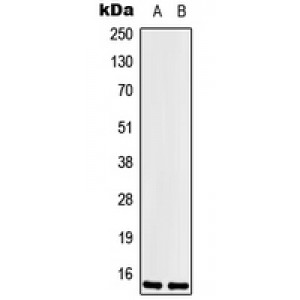 LifeSab™ LSM1 Rabbit pAb (50 µl)
