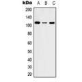 LifeSab™ STK31 Rabbit pAb (50 µl)