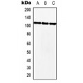 LifeSab™ MKL2 Rabbit pAb (50 µl)