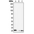 LifeSab™ CIB4 Rabbit pAb (50 µl)