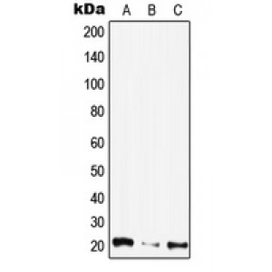 LifeSab™ CIB4 Rabbit pAb (50 µl)
