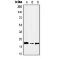 LifeSab™ IFNA1 Rabbit pAb (50 µl)