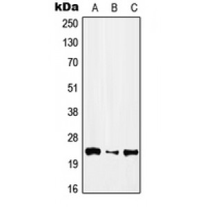 LifeSab™ IFNA1 Rabbit pAb (50 µl)
