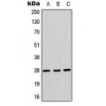 LifeSab™ AQP1 Rabbit pAb (50 µl)
