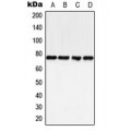 LifeSab™ BTK (pY223) Rabbit pAb (50 µl)