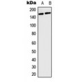 LifeSab™ COL4A5 Rabbit pAb (50 µl)