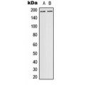 LifeSab™ DCC Rabbit pAb (50 µl)