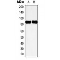 LifeSab™ Cortactin (pY466) Rabbit pAb (50 µl)