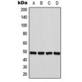 LifeSab™ FNTB Rabbit pAb (50 µl)