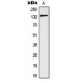 LifeSab™ mGLUR5 Rabbit pAb (50 µl)