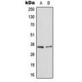 LifeSab™ Galectin 8 Rabbit pAb (50 µl)