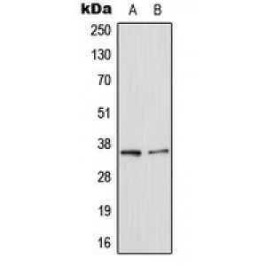 LifeSab™ Galectin 8 Rabbit pAb (50 µl)