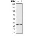 LifeSab™ MKK2 (pT394) Rabbit pAb (50 µl)