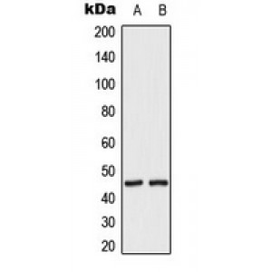 LifeSab™ MKK2 (pT394) Rabbit pAb (50 µl)
