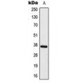 LifeSab™ ELOVL4 Rabbit pAb (50 µl)