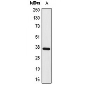 LifeSab™ ELOVL4 Rabbit pAb (50 µl)