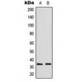 LifeSab™ GDF15 Rabbit pAb (50 µl)