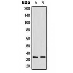 LifeSab™ GDF15 Rabbit pAb (50 µl)