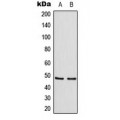 LifeSab™ TANK Rabbit pAb (50 µl)