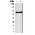 LifeSab™ PNPLA8 Rabbit pAb (50 µl)