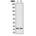LifeSab™ ELOVL1 Rabbit pAb (50 µl)