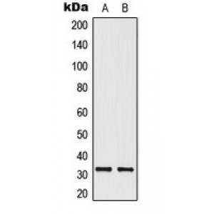 LifeSab™ ELOVL1 Rabbit pAb (50 µl)