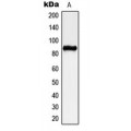 LifeSab™ CHSY2 Rabbit pAb (50 µl)