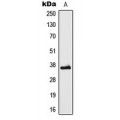 LifeSab™ LDLRAD3 Rabbit pAb (50 µl)