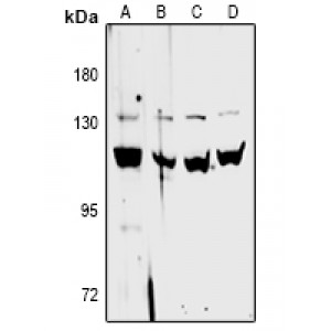LifeSab™ CFB Rabbit pAb (50 µl)