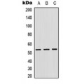 LifeSab™ CTSF Rabbit pAb (50 µl)