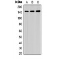 LifeSab™ HCAP (pS1083) Rabbit pAb (50 µl)