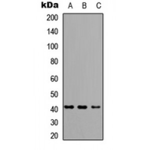 LifeSab™ HLA-A/B/C Rabbit pAb (50 µl)