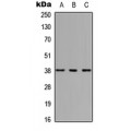 LifeSab™ HOXC10 Rabbit pAb (50 µl)