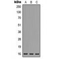 LifeSab™ MED31 Rabbit pAb (50 µl)