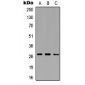 LifeSab™ MMP26 Rabbit pAb (50 µl)