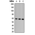 LifeSab™ MMP28 Rabbit pAb (50 µl)