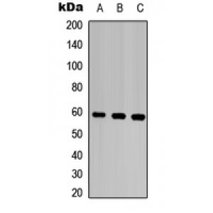 LifeSab™ MMP28 Rabbit pAb (50 µl)