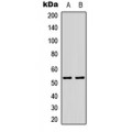 LifeSab™ p53 (AcK386) Rabbit pAb (50 µl)