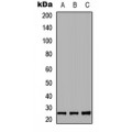 LifeSab™ RND2 Rabbit pAb (50 µl)