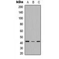 LifeSab™ SCD Rabbit pAb (50 µl)