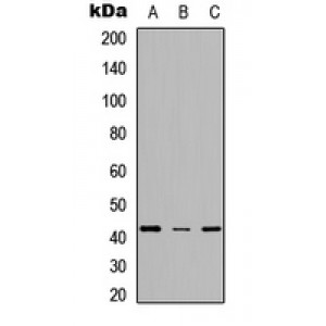 LifeSab™ SCD Rabbit pAb (50 µl)