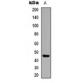 LifeSab™ ARRDC4 Rabbit pAb (50 µl)