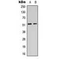 LifeSab™ CHRM1 Rabbit pAb (50 µl)