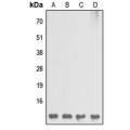LifeSab™ DBI Rabbit pAb (50 µl)