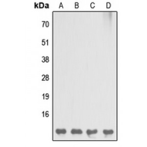LifeSab™ DBI Rabbit pAb (50 µl)